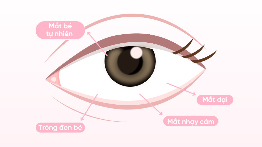 Các loại lens cho từng vấn đề về mắt, bạn đã biết?