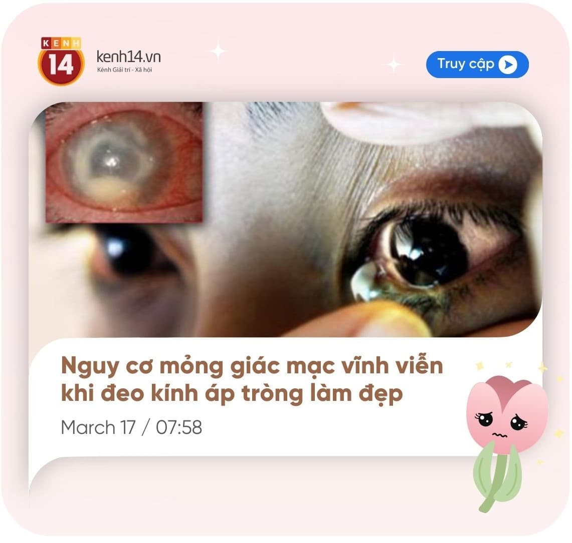 Đeo lens làm mỏng giác mạc (1).jpg