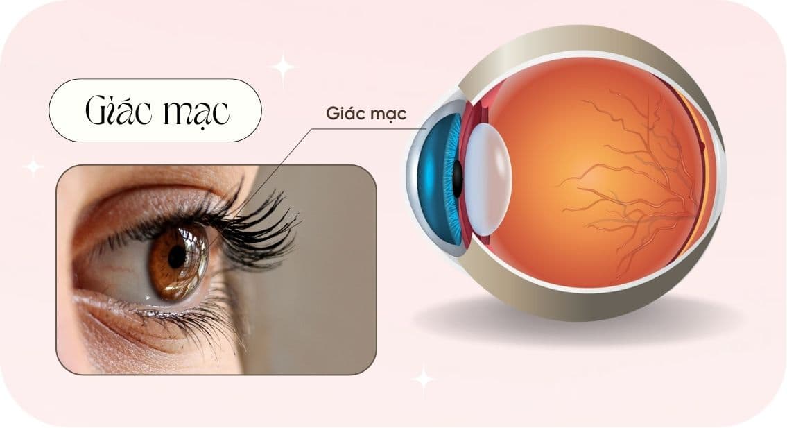 Đeo lens làm mỏng giác mạc (6).jpg