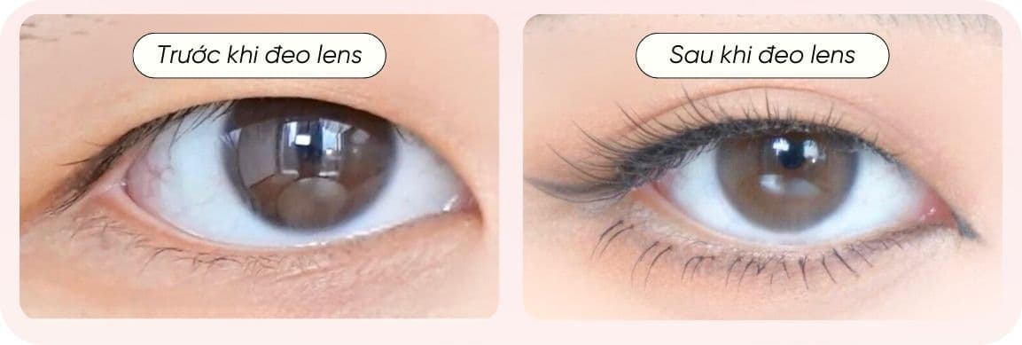 Ưu nhược điểm kính áp tròng (1).jpg