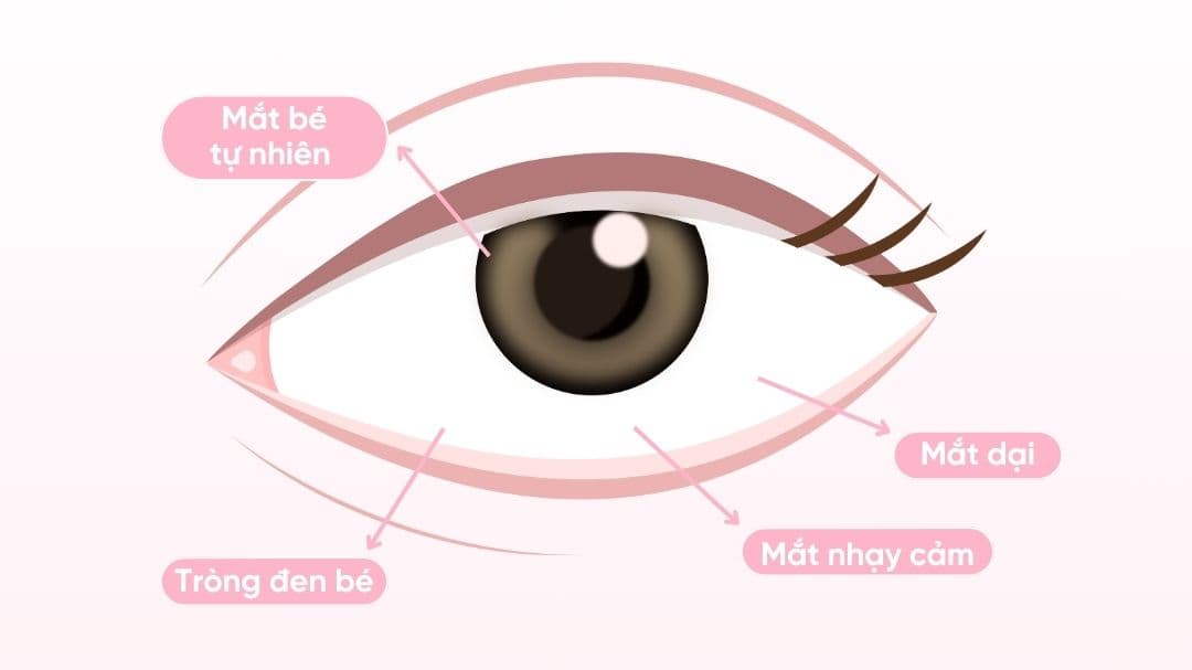54-  RẤT NÊN ĐỌC: Lens cho từng vấn đề về mắt và giải pháp đi kèm