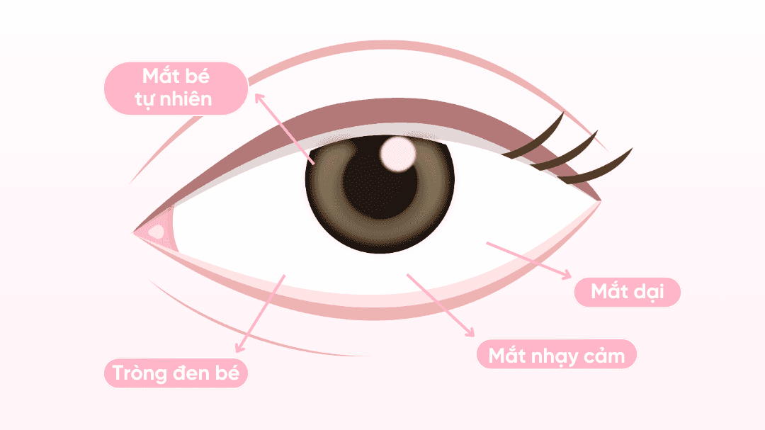 Các loại lens cho từng vấn đề về mắt, bạn đã biết?