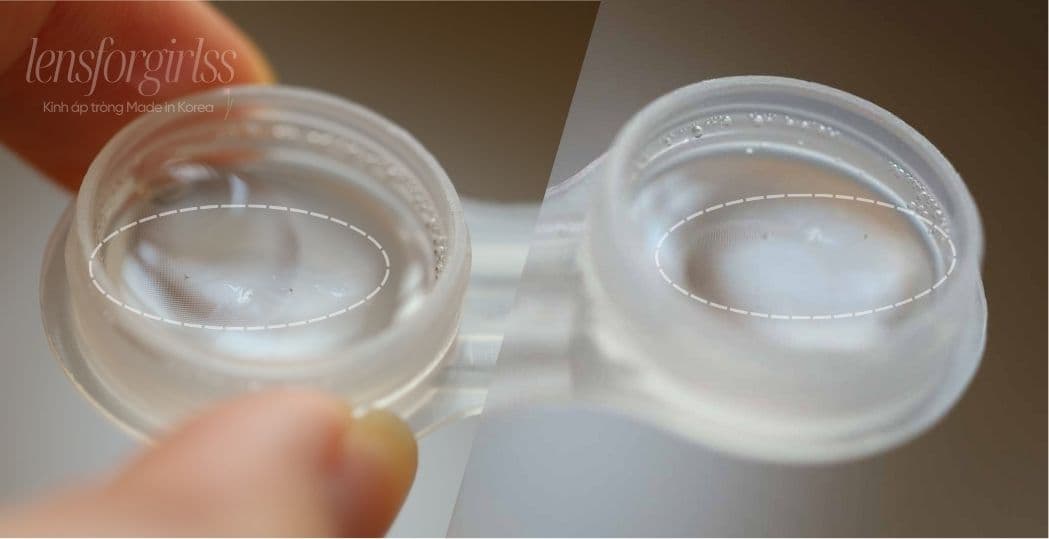 Cách khắc phục mắt tiết nhiều Protein (3).jpg