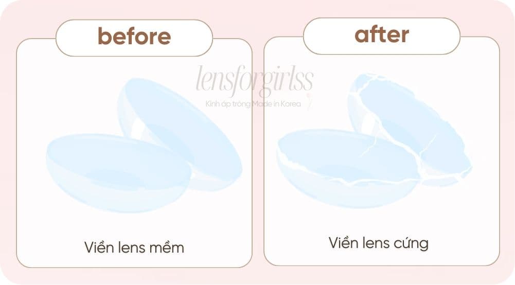 dấu hiệu lens hết hạn (1).jpg