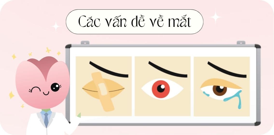 dấu hiệu tạm ngừng đeo lens (1).jpg