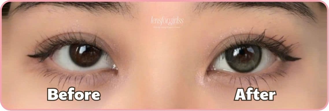 kính áp tròng cứu hộ cho mắt dại (3).jpg