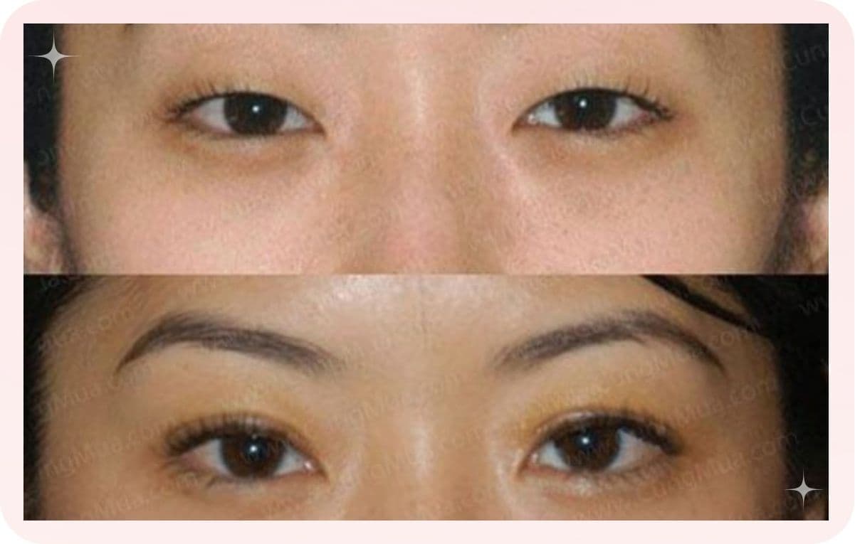 kính áp tròng cứu hộ cho mắt dại (4).jpg